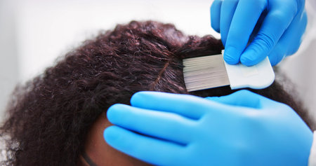 Scalp Treatment From Psoriasis And Dandruff. Dermatologist Doctor