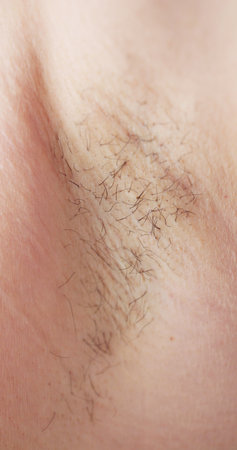 Young Woman With Hairy Armpit. Hair Removal And Shavingの写真素材