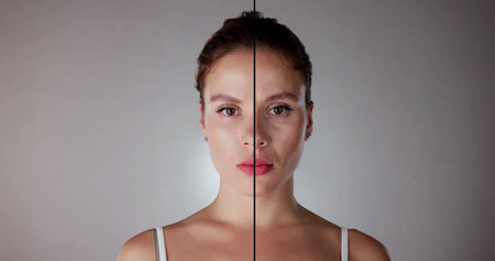 Woman Before And After Face Lift Therapy Injectionの写真素材