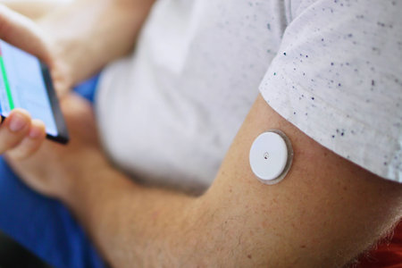 Continuous Glucose Monitoring System for Diabetic Man Using Phoneの写真素材
