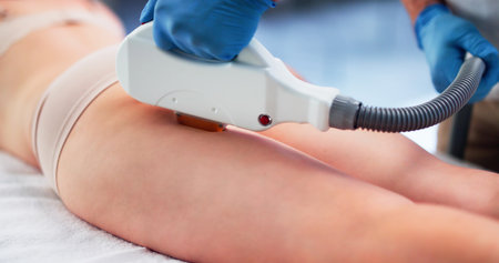 Close-up Of Woman Lying Receiving Epilation Laser Treatment On Buttockの写真素材