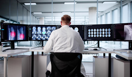 Doctor Examining Knee X-Ray On Computer Screen At Hospital Radiology.の写真素材