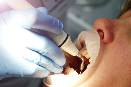 The dentist's office. Treatment of the patient's teeth.dentistの写真素材