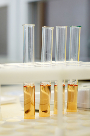 Glass vials with analyses. Medical equipmentの写真素材