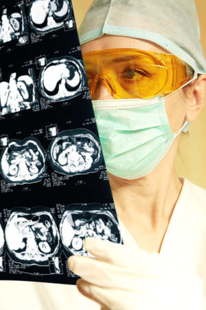 Woman doctor holding an x-ray in the hospital 