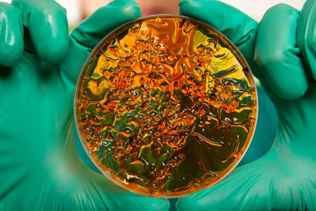 Scientist holding a petri dish with virus cellsの写真素材