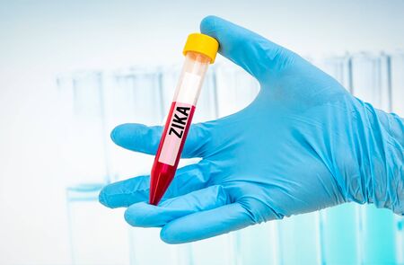 Scientists hand holding a test-tube with blood sample for ZIKA testの写真素材