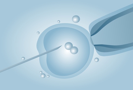 Microscopic artificial insemination, In vitro fertilisation (IVF) - vector illustrationのイラスト素材