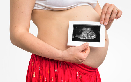Belly of a pregnant woman and ultrasound with baby isolated on white backgroundの写真素材