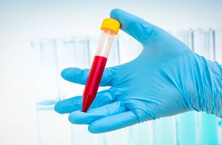 Scientists hand holding a test-tube with blood sample for BLOOD testの写真素材