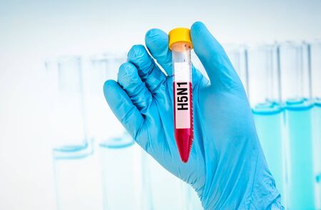 Scientists hand holding a test-tube with blood sample for H5N1 testの写真素材