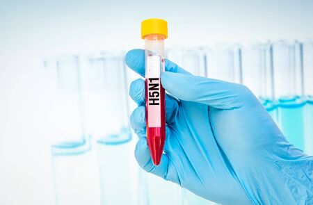 Scientists hand holding a test-tube with blood sample for H5N1 testの写真素材