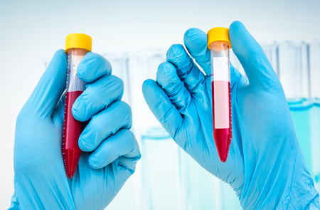 Scientists hand holding a test-tube with blood sample for blank labelの写真素材