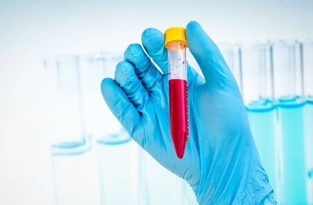 Scientists hand holding a test-tube with blood sample for BLOOD testの写真素材