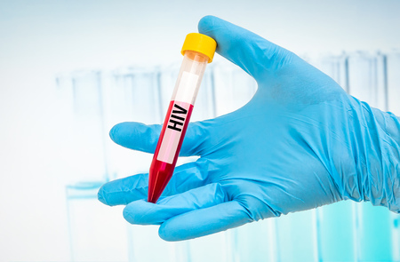 Scientists hand holding a test-tube with blood sample for HIV or AIDS testの写真素材