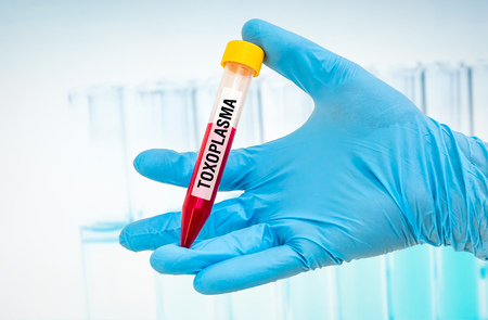 Scientists hand holding a test-tube with blood sample for TOXOPLASMA testの写真素材