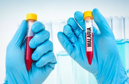 Scientists hand holding a test-tube with blood sample for MALARIA testの写真素材