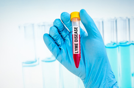 Scientists hand holding a test-tube with blood sample for LYME DISEASE testの写真素材