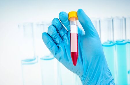 Scientists hand holding a test-tube with blood sample for blank labelの写真素材