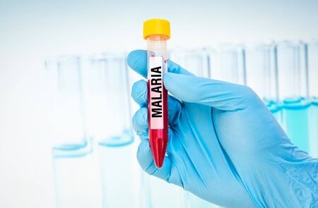 Scientists hand holding a test-tube with blood sample for MALARIA testの写真素材