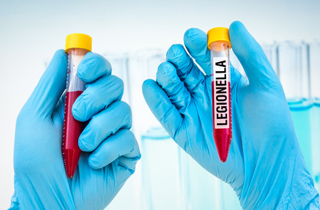 Scientists hand holding a test-tube with blood sample for LEGIONELLA testの写真素材