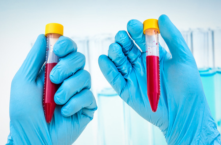 Scientists hand holding a test-tube with blood sample for BLOOD testの写真素材