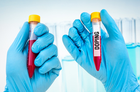 Scientists hand holding a test-tube with blood sample for DOPING testの写真素材