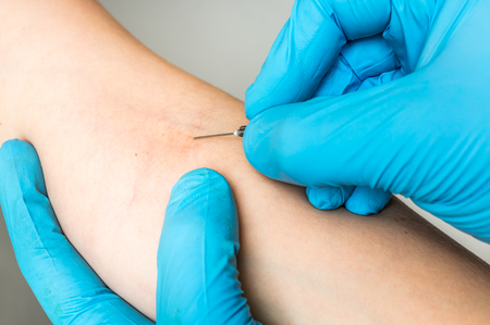 Doctor taking a blood sample for blood test from vein, close upの写真素材
