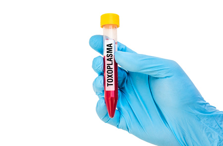 Scientists hand with blue rubber gloves holding a test-tube with blood sample for TOXOPLASMA isolated on whiteの写真素材
