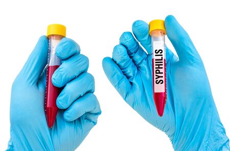 Scientists hand with blue rubber gloves holding a test-tube with blood sample for SYPHILIS isolated on whiteの写真素材