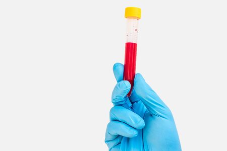 Test-tube in hand with blood isolated on gray backgroundの写真素材