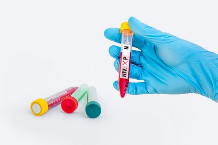 Scientists hand holding a test-tube with blood sample for HIV positive testの写真素材