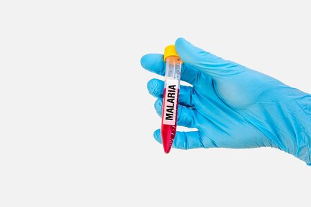 Scientists hand holding a test-tube with blood sample for MALARIA testの写真素材