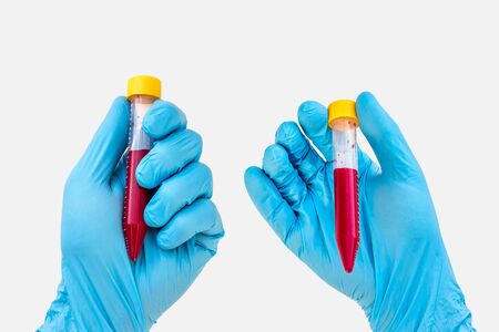 Test-tube in hand with blood isolated on gray background - scientist compare themの写真素材
