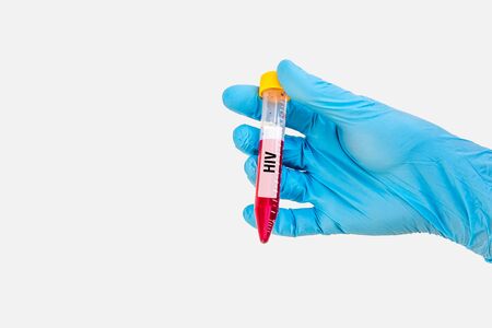 Scientists hand holding a test-tube with blood sample for HIV or AIDS testの写真素材