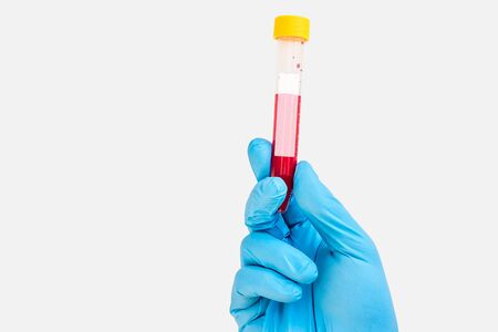 Scientists hand holding a test-tube with blood sample for blank labelの写真素材