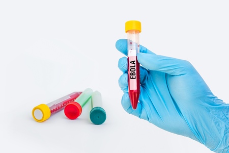 Scientists hand holding a test-tube with blood sample for EBOLA testの写真素材