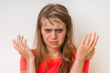 Portrait of a crying woman with bruised skin and black eyes - sadness and depression conceptの写真素材