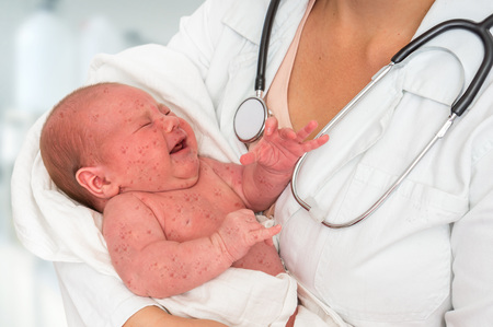 Doctor with stethoscope holding a newborn baby which is sick rubella or measlesの写真素材