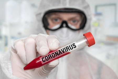 Hand of scientist is holding a test-tube with positive blood test on CORONAVIRUS COVID-19の写真素材
