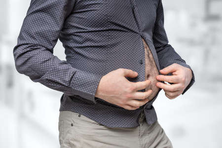 Fat belly of man which does not fit under the shirt - obesity conceptの写真素材