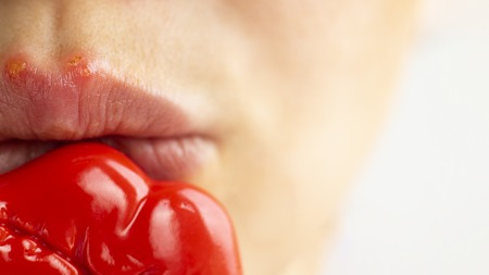 Part of a young woman face with red bubbles of virus herpes on lips that she tries to hide with toy lips for photo on patry. Medicine, treatment. Close up, horizontal, selective focusの写真素材