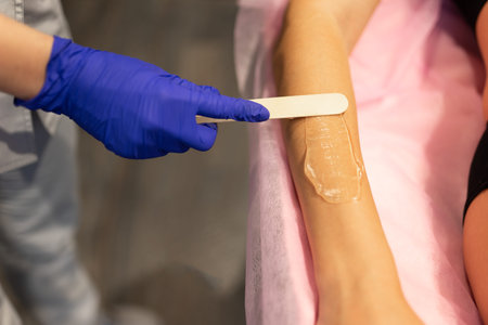 Beautician applies laser depilation gel to the patient's arm