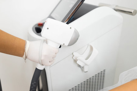 Hair removal specialist holds a laser in his hand