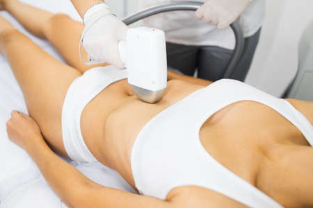 Woman on laser hair removal procedureの写真素材