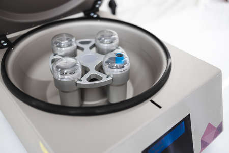 Plasmolifting centrifuge. Device for cosmetic rejuvenation procedureの写真素材