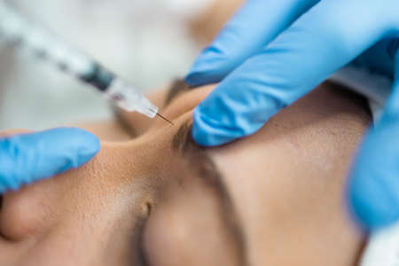 Close up of botox injection in the eyebrow or forehead of female patientの写真素材