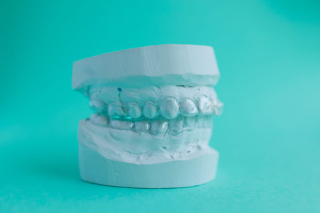Plaster model of the human jaw with transparent silicone essix retainer for dental correction