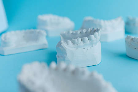 Gypsum models of human jaws on a blue backgroundの写真素材