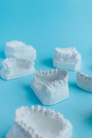 Dental casts of teeth on a blue backgroundの写真素材